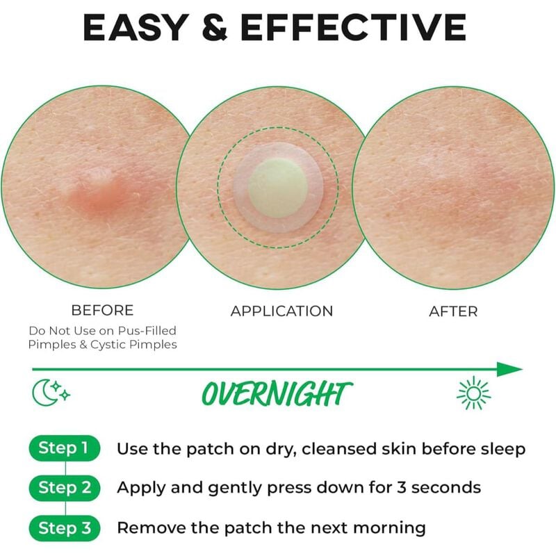 نولاهور لصقات دقيقة للحبوب في مراحلها الأولى &ndash; الخطوة الأولى