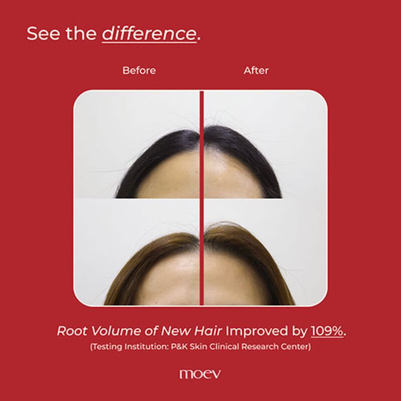 moev annurcatin hair strengthening