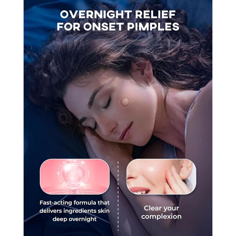 نولاهور لصقات دقيقة للحبوب في مراحلها الأولى &ndash; الخطوة الأولى