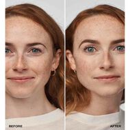 faces ايفين بيتر  كلينيكال مع عامل حماية من الشمس 20