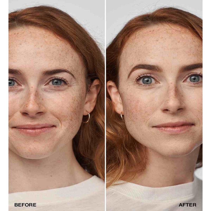 كلينيك ايفين بيتر  كلينيكال مع عامل حماية من الشمس 20