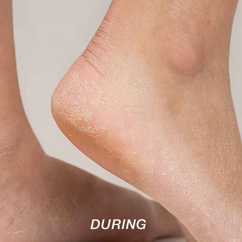 starskin magic hour exfoliating foot mask socks