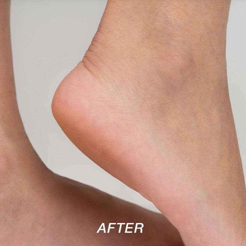 starskin magic hour exfoliating foot mask socks