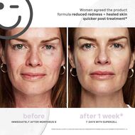 faces kateceuticals supercell rejuvenation serum