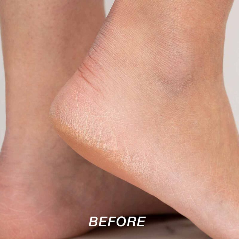 starskin magic hour exfoliating foot mask socks