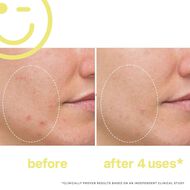 معالج فيتامين سي المضيء للوجه من ميجا سي 30 faces معالج فيتامين سي المضيء للوجه من ميجا سي 30