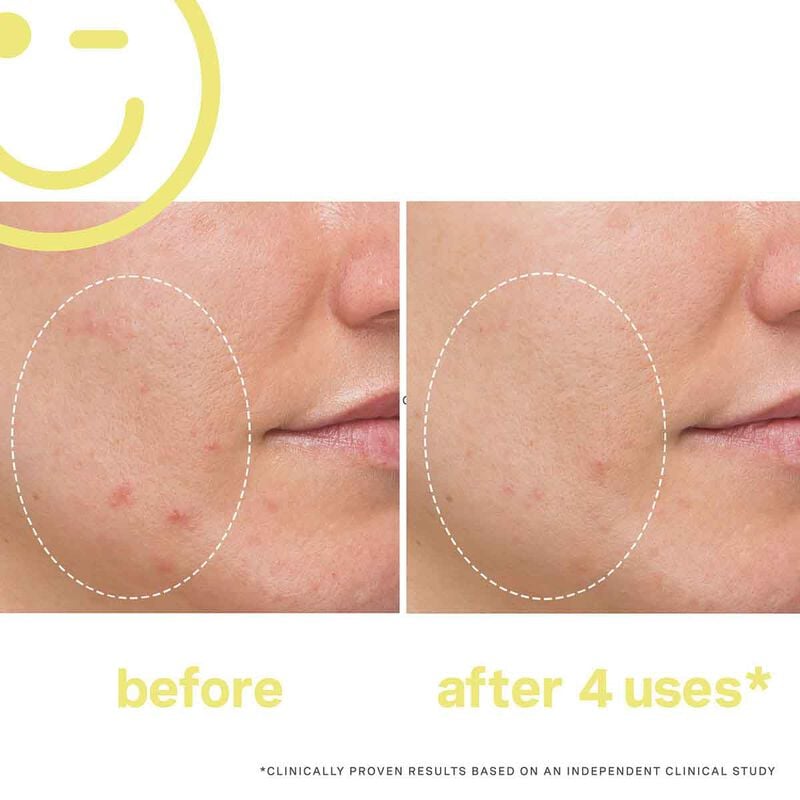 كيت سومرفيل معالج فيتامين سي المضيء للوجه من ميجا سي 30