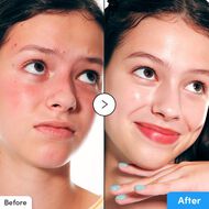 faces hyaltoin flooding serum
