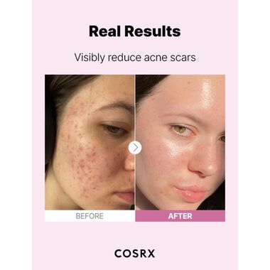 faces سيروم النياسيناميد 15