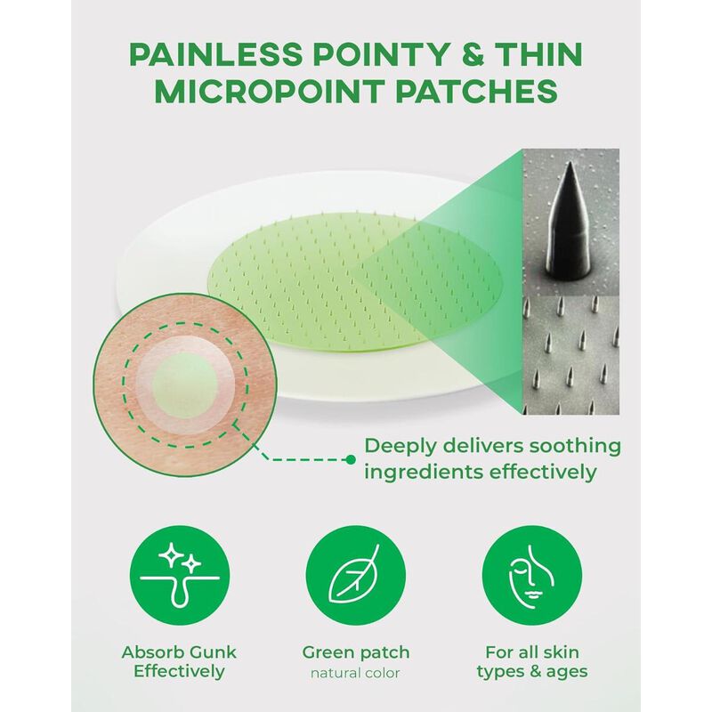 نولاهور لصقات دقيقة للحبوب في مراحلها الأولى &ndash; الخطوة الأولى