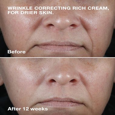 faces سمارت كلينيكال إصلاح كريم مصحح مضاد للتجاعيد 50مل