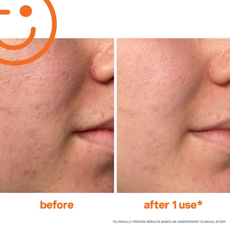 kate somerville exfolikate intensive exfoliating treatment