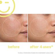 معالج فيتامين سي المضيء للوجه من ميجا سي 30 faces معالج فيتامين سي المضيء للوجه من ميجا سي 30