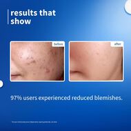 faces 10  niacinamide face serum with rice water