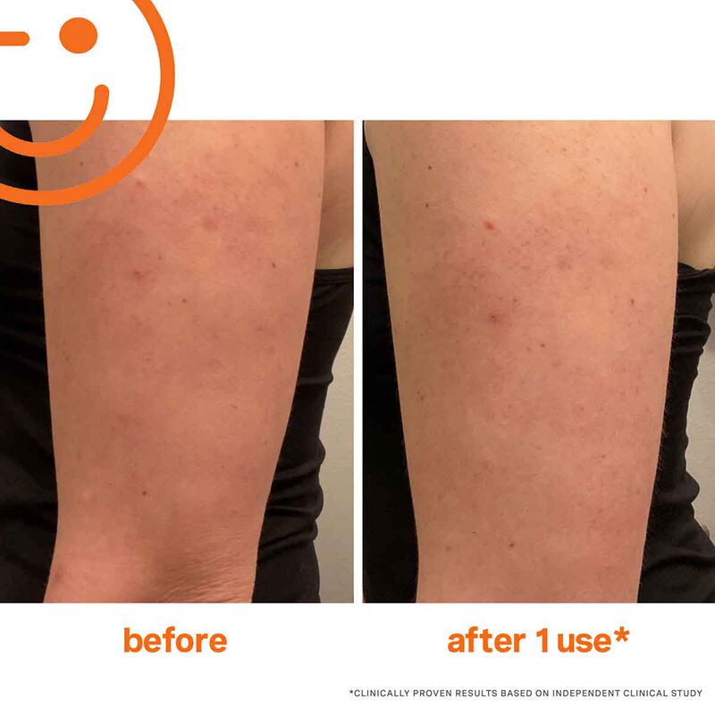 kate somerville exfolikate resurfacing body scrub