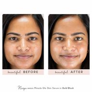 Miracle Glo Skin Serum faces miracle glo skin serum