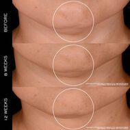 Rénergie 300-Peptide faces r nergie 300 peptide