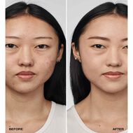 ايفين بيتر كلينيكال مع عامل حماية من الشمس 20 faces ايفين بيتر كلينيكال مع عامل حماية من الشمس 20