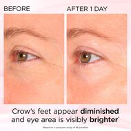 Retinol + HPR Ceramide Rapid Skin Renewing faces retinol hpr ceramide rapid skin renewing