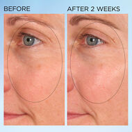 faces visible brightening clearly radiant spot correcting  capsules