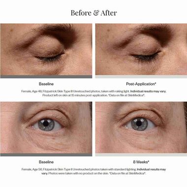 faces كريم العين انستانت برايت