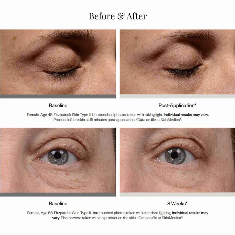 skinmedica instant bright eye cream