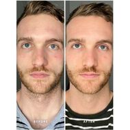 faces سيروم فيتامين ب مع 5 نياسيناميد