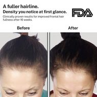 PowerFlex 272 Hair Growth Laser Light Cap faces powerflex 272 hair growth laser light cap