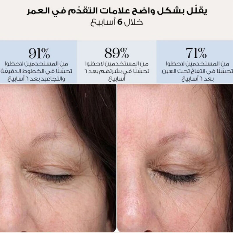 سموث سكين رقع العين led للعلاج بالضوء الأحمر + هيدروكولويد