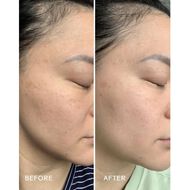 Radiance Grape Stem Cell plus Squalane Day Cream faces radiance grape stem cell plus squalane day cream