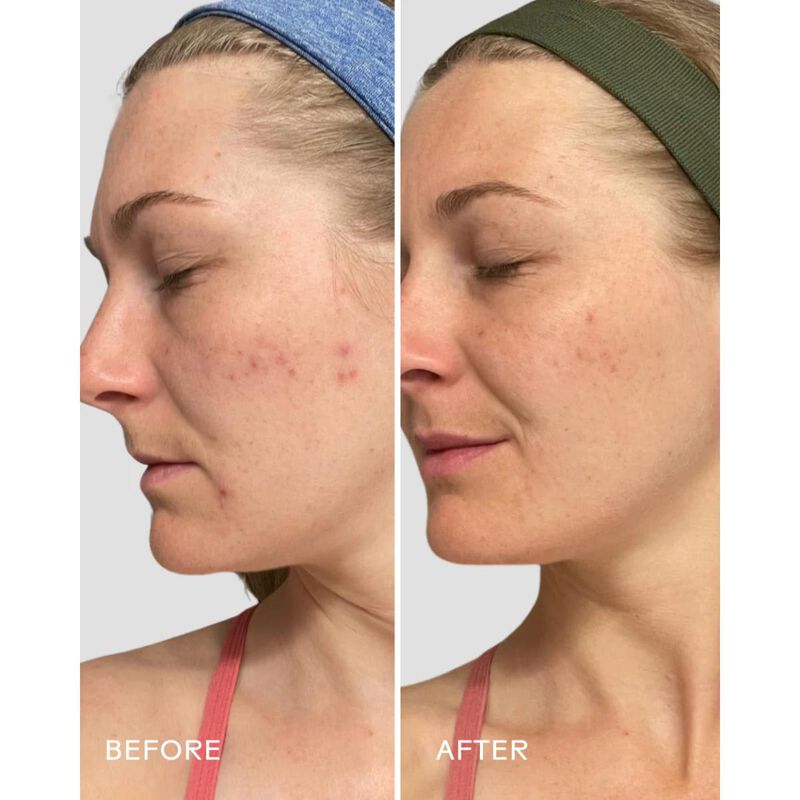 three ships refresh papaya plus salicylic acid cleanser