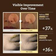 All Advanced Retino-Mela Serum faces all advanced retino mela serum
