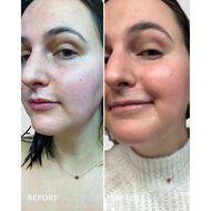 faces skin hero bakuchiol   calendula bio retinol serum