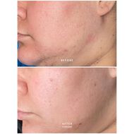 faces calm pure radiance oil