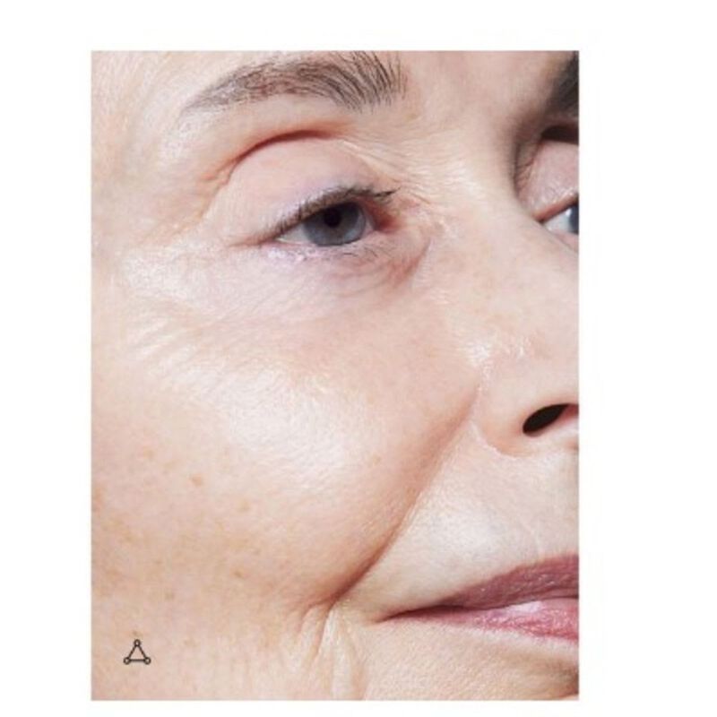 allies of skin promise keeper nightly blemish treatment