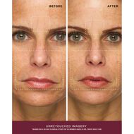 faces سيروم ريدينس للوجه