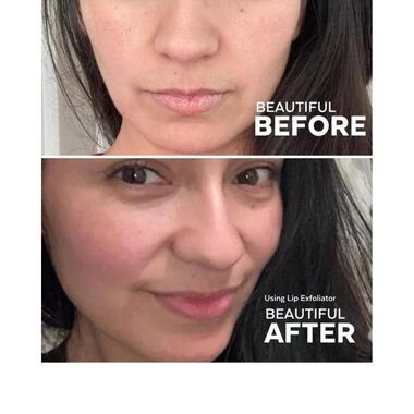 faces مجموعة ترطيب الشفاه ومعالجتها