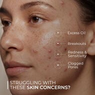 Acne Night Cream faces acne night cream