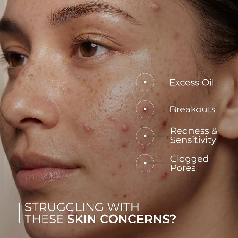 skin centrick acne night cream
