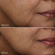 faces bakuchiolسيرو الوجه