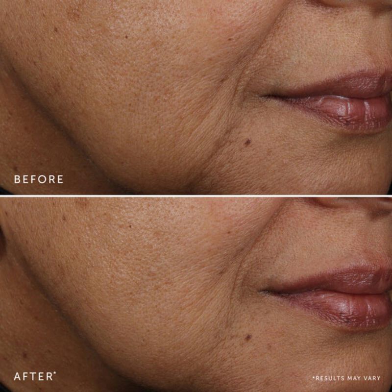 هيربيفور bakuchiolسيرو الوجه