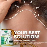 faces intensive anti hair loss treatment lotion