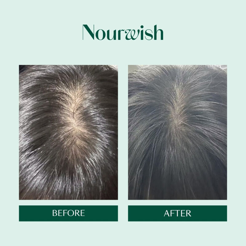 نورويش شامبو تجديد فروة الرأس سكالـب ريتريت