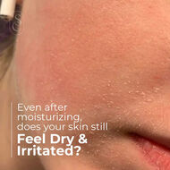 CicaDerm cream faces cicaderm cream