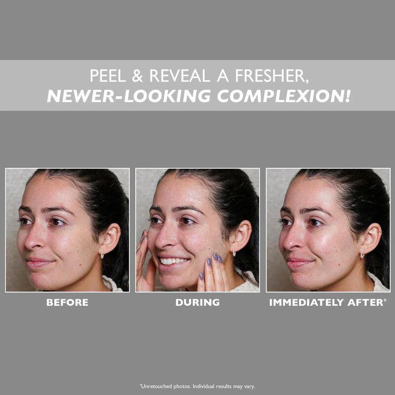 peterthomasroth جل التقشير المشدد