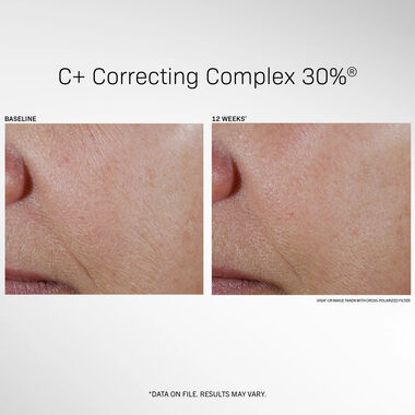 faces c correcting complex 30