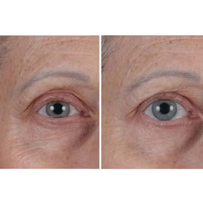 بيريكون إم دي كولد بلازما بلس ذا ايسنس