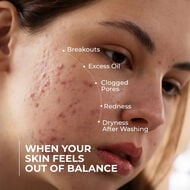 Acne Face Wash faces acne face wash