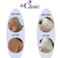 faces prebiotic collagen facial cream