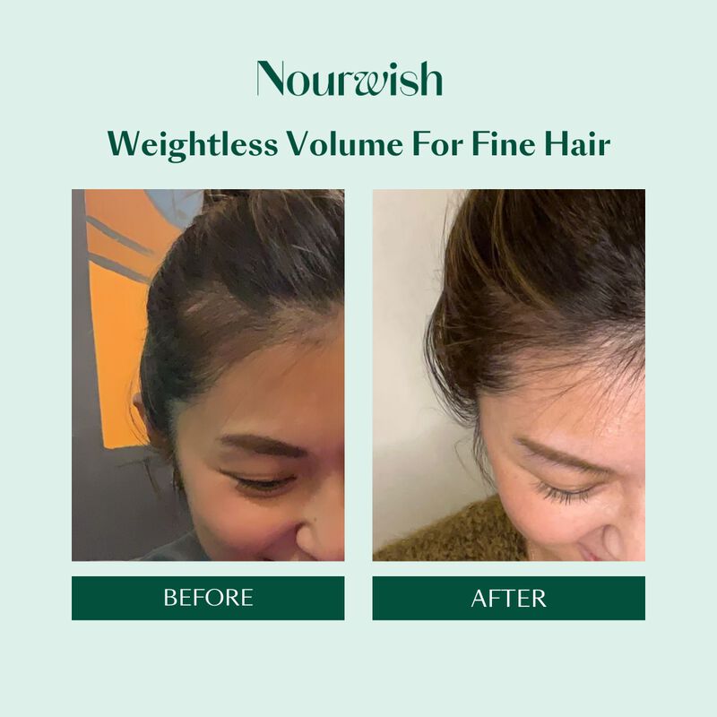 نورويش شامبو تجديد فروة الرأس سكالـب ريتريت